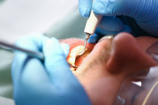 Best Pediatric Emergency Dentist in Hopkinsville, KY