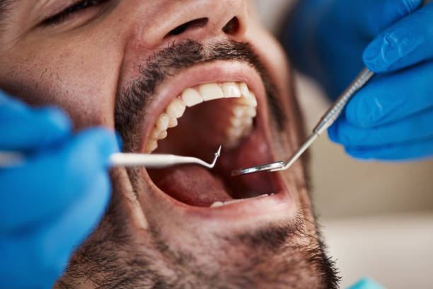 Fast & Reliable Emergency Dental Services in KY